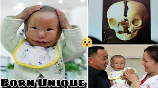 Chinese Boy Born With 'Two Faces' 😮