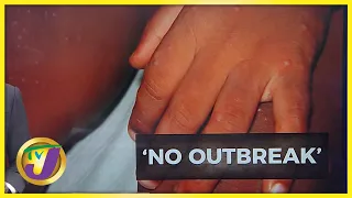 No Hand, Foot & Mouth Outbreak | TVJ News - Mar 4 2022