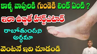 Natural Tips to Control Swellings | Heart Attack | Blood Circulation | Dr. Manthena's Health Tips