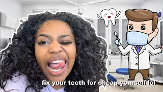 DIY VENEERS TUTORIAL | FIXING ALL GAPS IN MY TEETH MYSELF WITH COMPOSITE | BEAUTY BY PRIMA