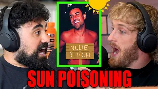 George Got Sun Poisoning At A NUDE Beach In Australia!