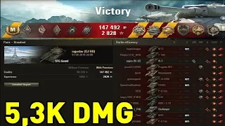 STG Guard - 5.3K Damage - 11 Kills | World of Tanks