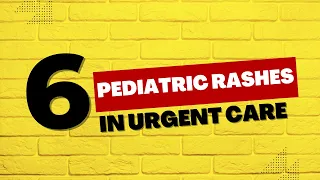 6 Pediatric Rashes in Urgent Care