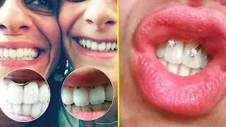 Smiley Piercing◄►Tout ce que vous devez savoir