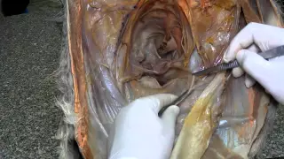 Abdominal muscles & inguinal canal by dr khaled shoghy