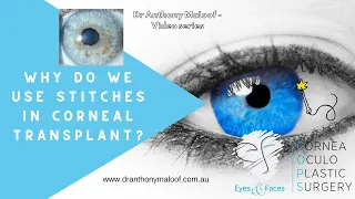 Why do we use stitches in corneal transplant surgery -  Dr Anthony Maloof - Sydney, Australia