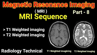 MRI # Part - 8 # MRI Sequences # T1 Weighted Imaging & T2 Weighted Imaging # || By BL Kumawat || #