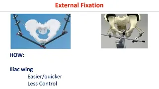 Pelvic Fractures- Initial Management