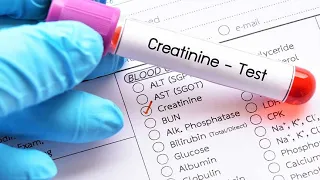 What is Creatinine Blood Test? Normal Range