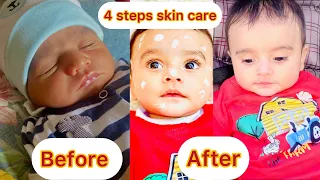 How to make baby skin fair naturally | some tips for baby’s fair skin