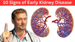 10 Signs of Early Kidney Disease & Kidney Labs You Need