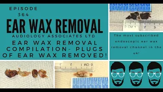 EAR WAX REMOVAL COMPILATION   PLUGS OF EAR WAX REMOVED   EP364