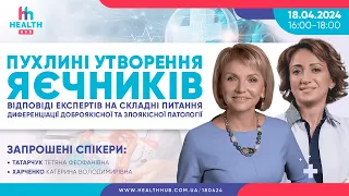 Пухлині утворення яєчників. Відповіді експертів на складні питання диференціації патології