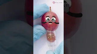 Mrs Grape VACUUMBIRTH😱 - TWINS GOT SUCKED OUT🤣🍇 #fruitsurgery #animation #foodsurgery