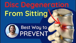 Fix Your Sitting Posture To Stop Back and Neck Pain | Effect on Your Discs