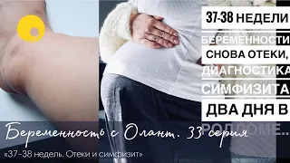 БЕРЕМЕННОСТЬ 37-38 НЕДЕЛИ ДВА ДНЯ В РОДДОМЕ СИМФИЗИТ СТИМУЛЯЦИЯ РОДЫ