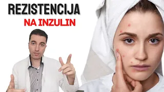 Da li Vaše tijelo odbija INZULIN? Ovo su 12 znakova INZULINSKE REZISTENCIJE...