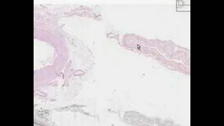 Shotgun Histology Medium Artery and Vein