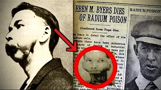 Horrific history of a man whose jaw fell off| Eben Byers