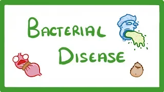 GCSE Biology - What Are Bacterial Diseases? - Treatment and Prevention #37