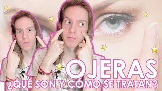 ¿CÓMO SE TRATAN LAS OJERAS? Aprende a diagnosticar y tratar tu tipo de ojeras