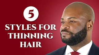 Is Your Hair Thinning? Try These 5 Classic Men's Hairstyles!