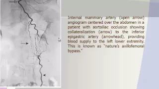 Imaging of Aorta 1   Prof Dr  Hassan El kiki In Arabic