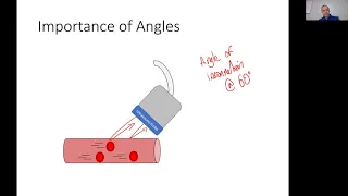 Angles in Ultrasound