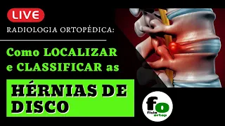 LIVE Hernia de Disco: Avaliação Radiológica