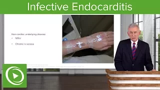 Infective Endocarditis (IE): Definition & Epidemiology– Infectious Diseases | Lecturio