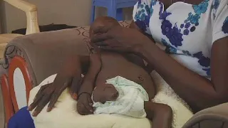 Birth defects surge in South Sudan