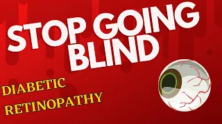 Prevent Going Blind from Diabetes. Diabetic Retinopathy (Treatment 2022)