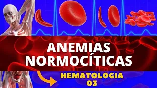 ANEMIAS NORMOCÍTICAS (ANEMIAS) - HEMATOLOGIA