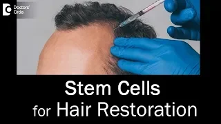Are stem cells effective for hair restoration? - Dr. Rasya Dixit