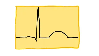 Po mojemu: EKG cz. 2