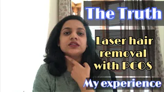 Laser Hair Removal with PCOS| sharing my experience