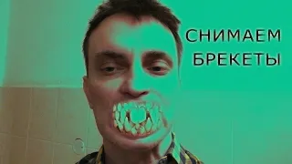 11 месяцев. Весёлые улыбки.