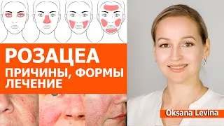 РОЗАЦЕА. Почему появляется, какая бывает и как лечить