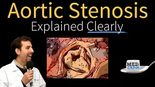 Aortic Stenosis Explained Clearly - Diagnosis and Treatment