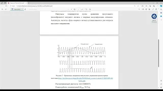 Моделирование частотно-регулируемого электропривода