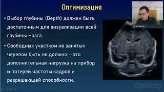 «Оптимизация изображения и возможности визуализации мозжечка  Оценка кровоизлияний в мозжечок»