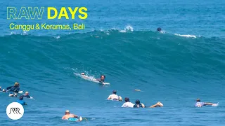 RAW DAYS | Canggu & Keramas, Bali | Fun surfing session with Metal Neck Crew