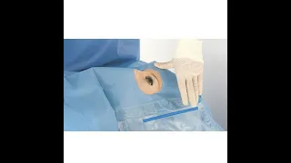 Phacoemulsification: How to apply the disposable drape?