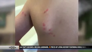 Bozeman hotel responds to family's complaint of bedbugs