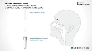 Video Guide for STANDARD Q COVID 19 Ag test