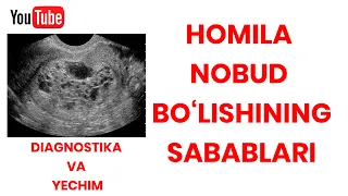 HOMILANI NOBUD BO'LISHI