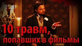 10 травм, попавших в фильмы