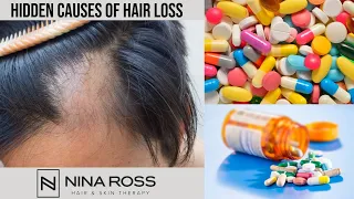 Are Your Prescription Medications Causing Hair Loss?| Hair Loss Treatment for Men & Women