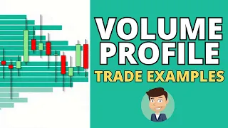 Volume Profile Trade Examples (S&P 500, GOLD, OIL, BITCOIN, EUR/USD) - How to Use Volume Profile