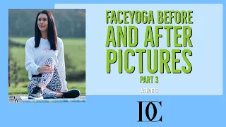 Before And After Face yoga  Pictures Part 3 #Shorts￼ #faceyoga #face massage